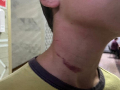 В Киевской области отчим пытался задушить 12-летнего пасынка компьютерным кабелем