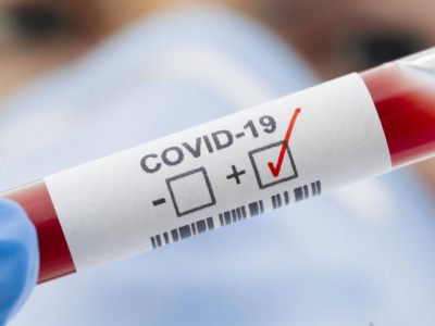В столице растёт количество заражённых COVID-19 - санврачи