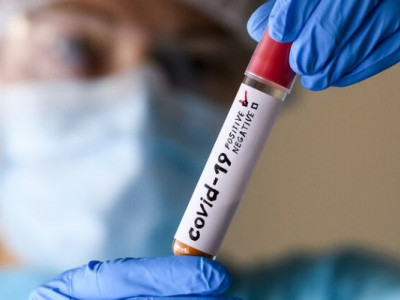 В Украине растет заболеваемость COVID-19