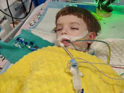 Умершего мальчика во Львове после удаления молочных зубов оперировали врачи без соответствующей квалификации – заключение экспертов
