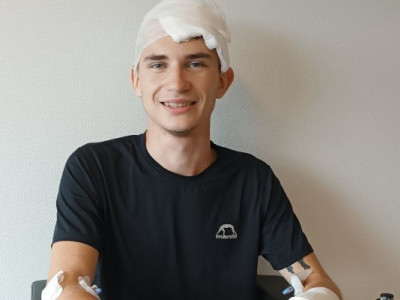 В Польше подростка из Украины избили и отрубили ему палец
