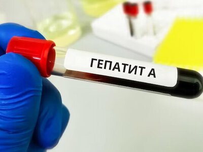 В Киеве зафиксировали вспышку гепатита А