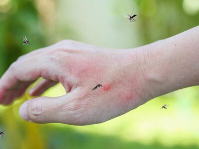Как не дать комарам испортить лето: 8 рецептов, о которых знали ещё наши прабабушки