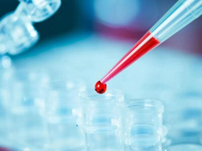Ученые обнаружили антитело, блокирующее почти все варианты ВИЧ-инфекции