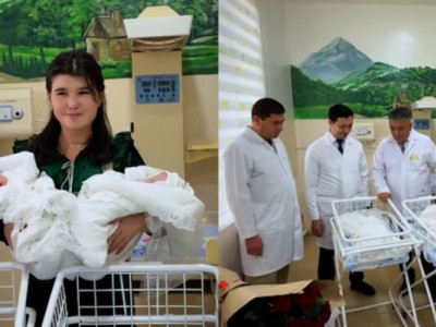В Узбекистане успешно разделили сиамских близнецов