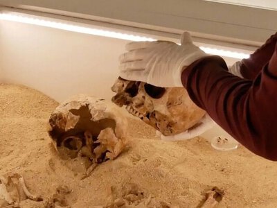 Древнее захоронение содержало редкое генетическое заболевание