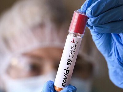 В Украине зарегистрировали первый случай нового варианта коронавируса Цикада. Какие симптомы? 