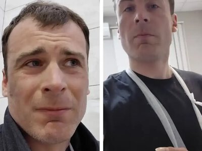 Полз по улице от боли: в Одессе забронированный артист обвиняет ТЦК в увечье