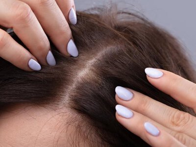 Волосы выпадают? Три вещи, которые могут реально изменить ситуацию