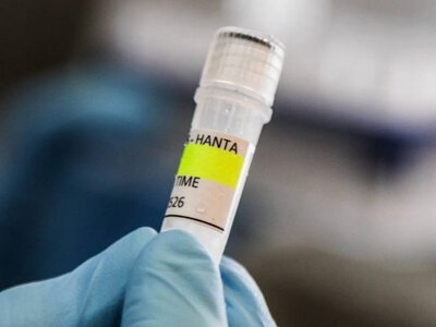Есть ли вакцина от хантавируса: что говорят ученые о смертельном вирусе