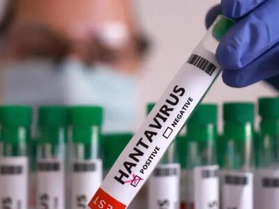 Хантавирус в Украине: где зафиксирован и как распознать опасную болезнь