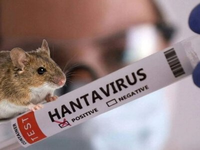 Хантавирус в Украине – три простых вещи, которые защитят вас от заражения (видео)