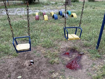  Трехлетнюю девочку, попавшую под обстрел на детской площадке в Херсоне, привезли в Николаев