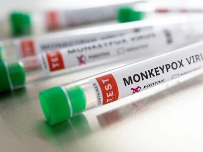 Постоянно так делаю: в аэропорту США поймали ученого, который вез в багаже смертельный вирус