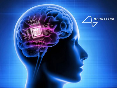 Samsung выпустит 4-нм нейрочипы для Neuralink.