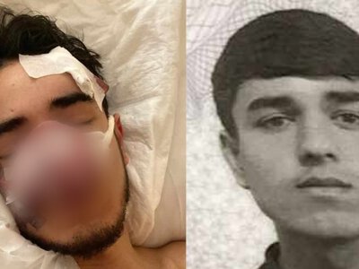 В России напали на 21-летнего таджикистанца. Ему отрезали нос, ранили ухо и ногу
