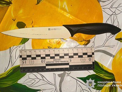В Николаеве женщина ударила соседку ножом в живот во время конфликта из-за собаки