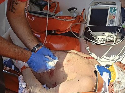 ДТП с фурой под Николаевом: водитель легковушки погиб, пассажирка в тяжелом состоянии