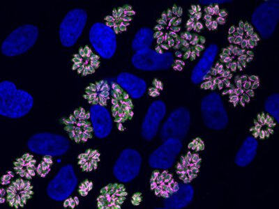 Toxoplasma навчився виживати у переповненій клітині: вчені знайшли механізм його адаптації