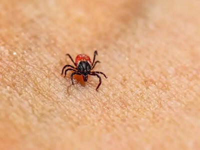  В Акмолинской области за сезон клещевыми инфекциями заразились 9 человек 