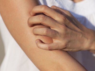 Свербить шкіра, але висипу немає: коли цей симптом потребує перевірки крові
