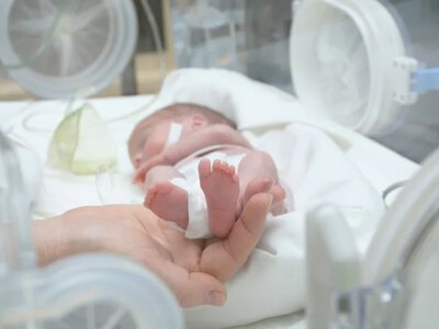 С 22 недель: как проходит выхаживание преждевременно родившихся детей