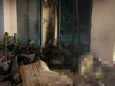 В Киевской области увеличилось число погибших: в больнице скончался ребенок