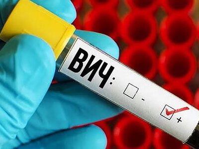 В Николаевской области растет число выявленных случаев ВИЧ: данные за сентябрь