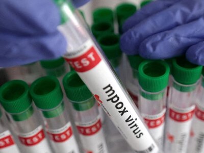 В двух регионах России по подозрению на оспу обезьян госпитализированы 10 человек
