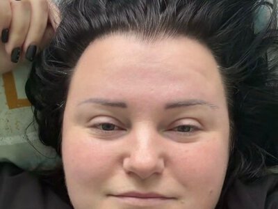 Сьогодні найгірше: alyona alyona вперше вийшла на зв'язок після зменшення шлунка