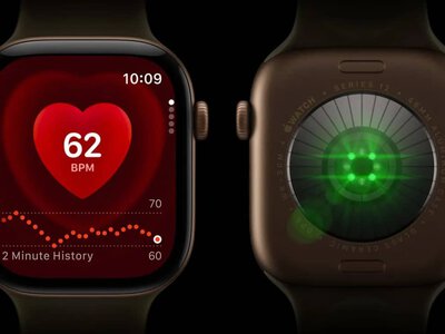 Уведомление Apple Watch о высоком пульсе помогло женщине вовремя обратиться к врачам