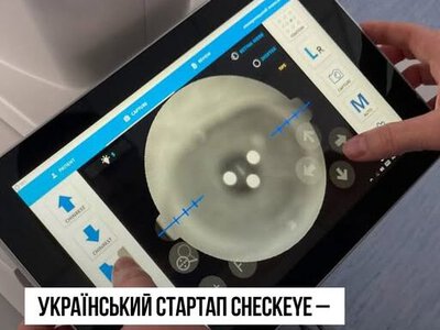 Украинский стартап CheckEye занял второе место на международном конкурсе медицинских инноваций